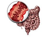 Điều trị bệnh Crohn: Các loại thuốc phổ biến để điều trị bệnh Crohn