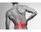 Nguyên nhân nào gây ra chứng đau lưng? (Chẩn đoán và điều trị)