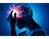 Tai biến mạch máu não là gì? Nguyên nhân và triệu chứng là gì?